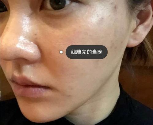 脸上长毛图片,从成因到解决方案